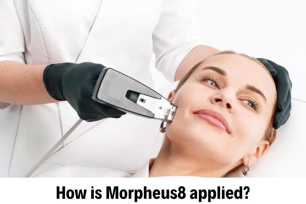 Morpheus 8